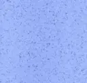 Azure